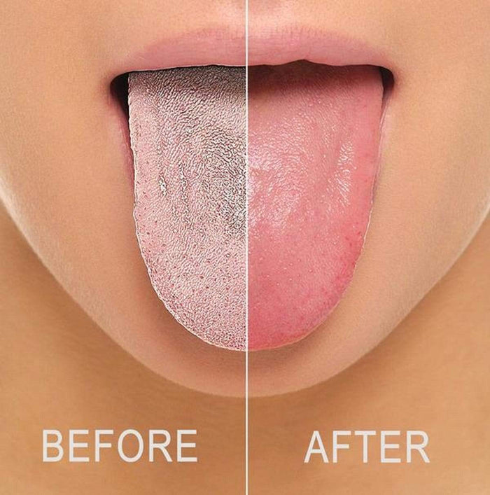 Tongue Scraper Cleaner